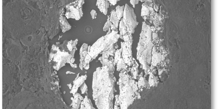Calcification scientific image