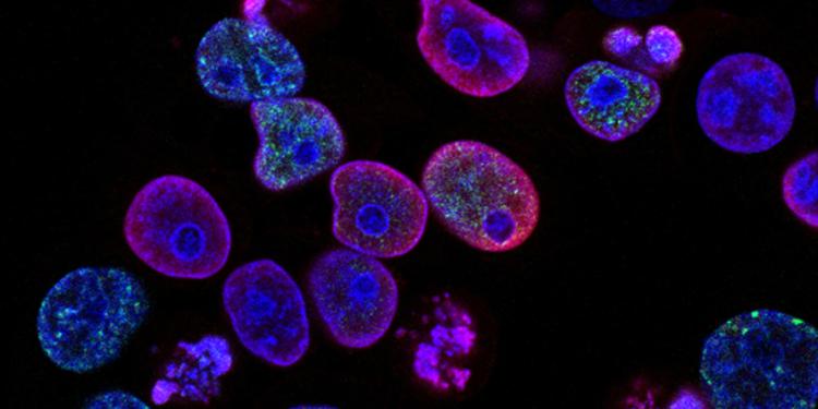 Cancer cells
