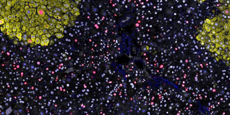 Proliferating liver IF