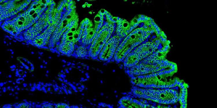E-cadherin immunostaining in mouse colon