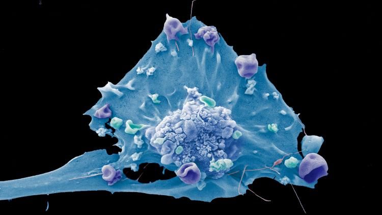 Breast cancer cell_Anne Weston Francis Crick Institute