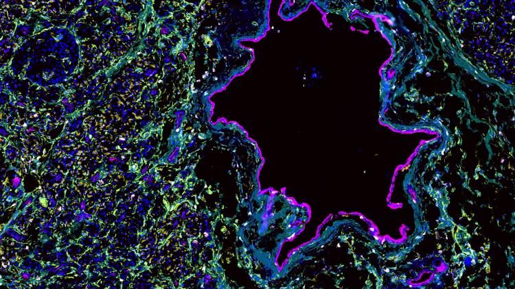 Spatial proteomics analysis of human pancreas tissue