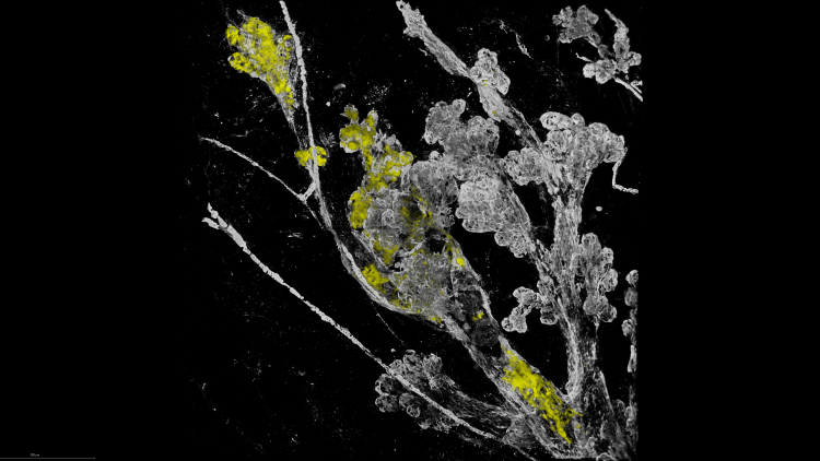 Healthy mammary tissue (ductal structures with sometimes small side branches). The coloured patches are the mutant cells that managed to survive and expand within the healthy tissue
