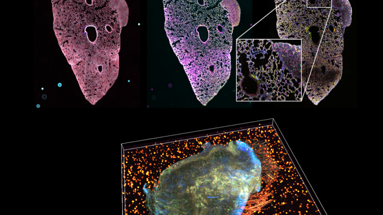 Mutimodal analysis in 3D of a 4T1-derived tumour