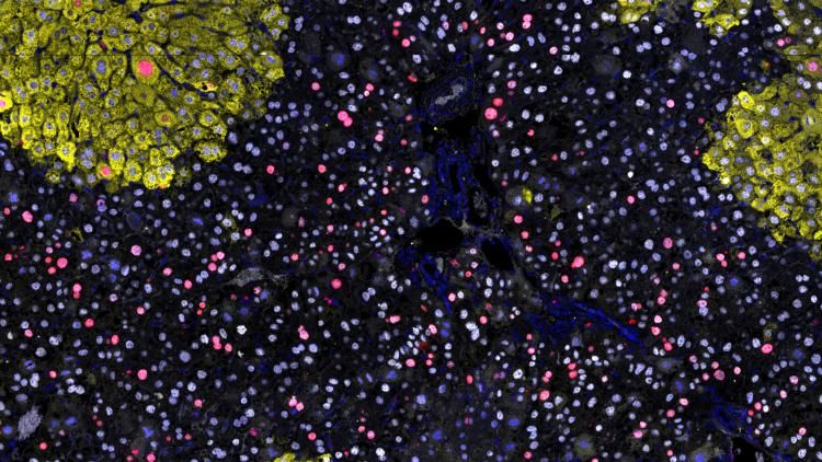 Proliferating liver IF