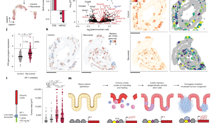 Epigenetic memory of colitis promotes tumour growth | Nature 
