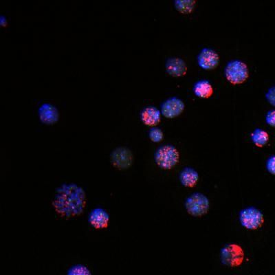 Engineered Myc-containing ecDNAs 