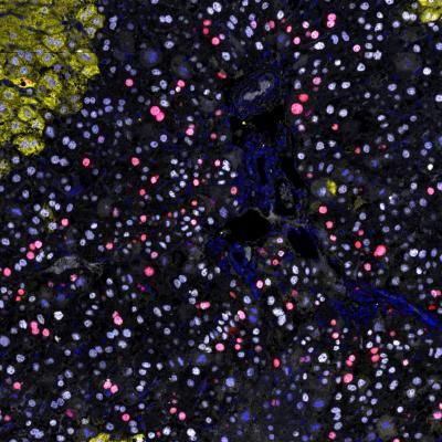 Proliferating liver IF