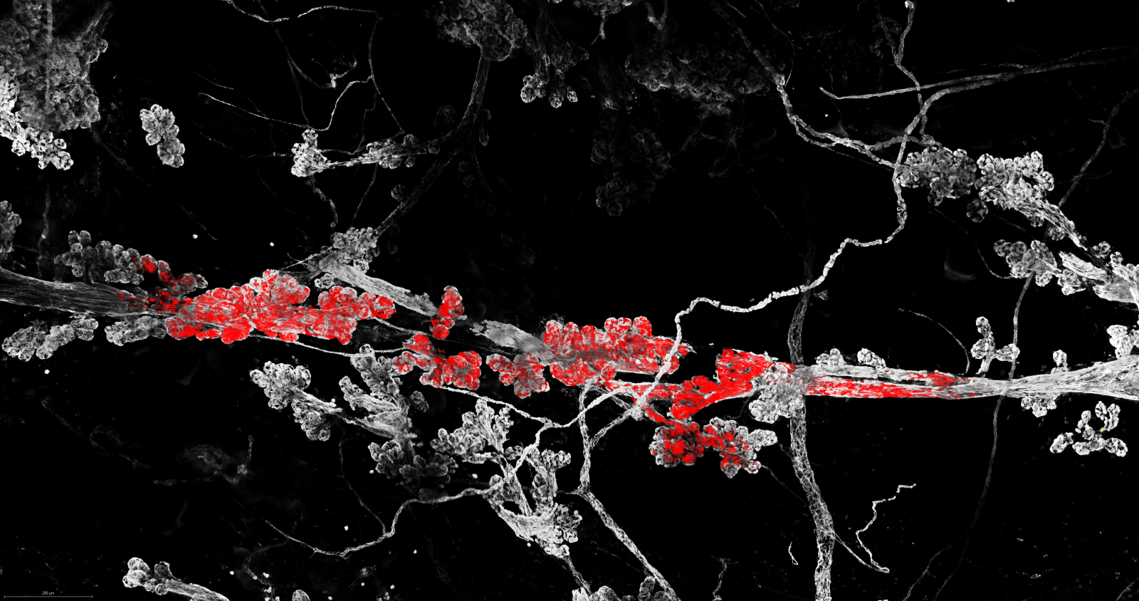 Healthy mammary tissue (ductal structures with sometimes small side branches). The coloured patches are the mutant cells that managed to survive and expand within the healthy tissue
