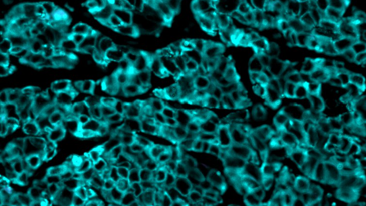 CyCIF imaging of TNBC patient derived xenografts displaying expression of basal marker CK14 (cyan) after placebo control treatment
